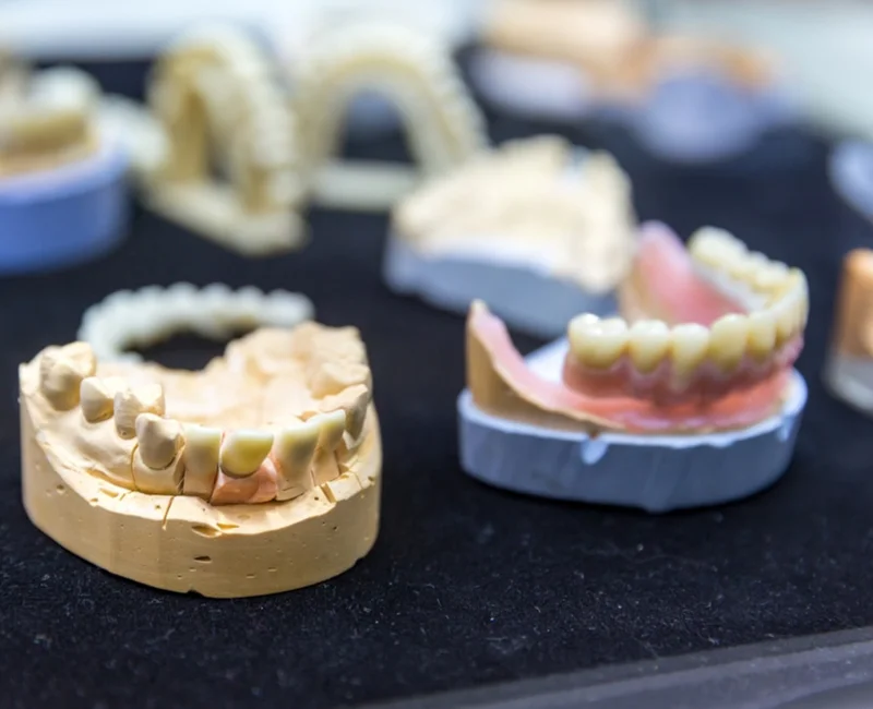 Snap-In Implant Dentures