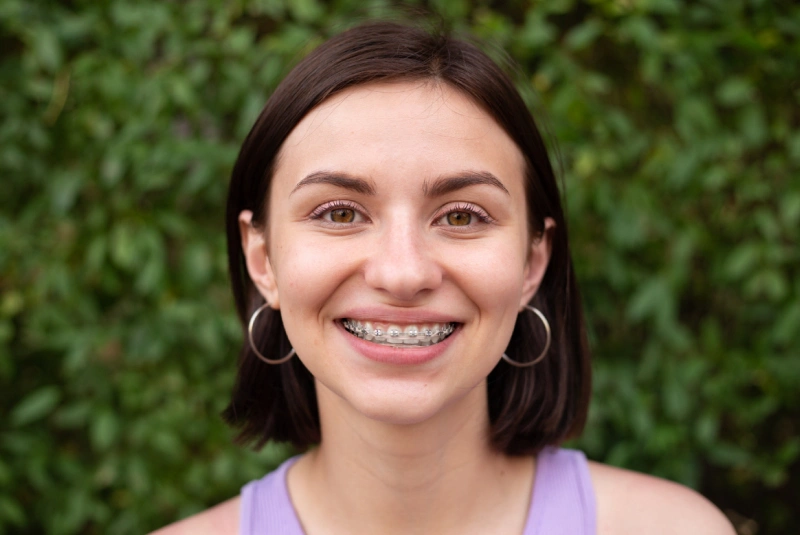 Benefits - Damon Braces in The Woodlands, TX