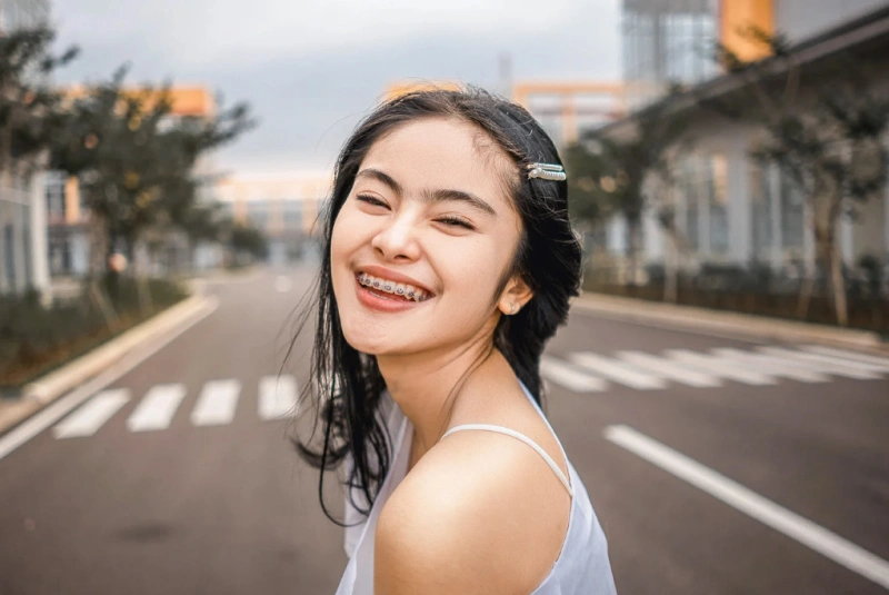 Damon Braces in The Woodlands, TX - Dentistry and Orthodontics