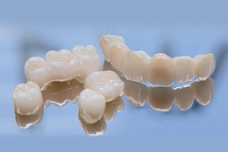 Types - Dental Bridges in The Woodlands, TX