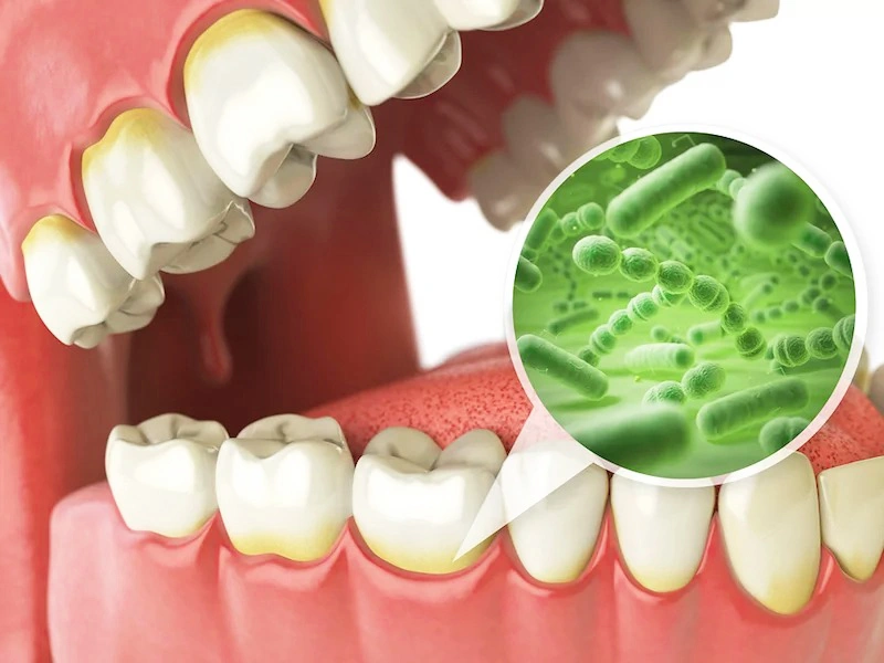 Dental Cleanings in The Woodlands, TX - Dentistry and Orthodontics