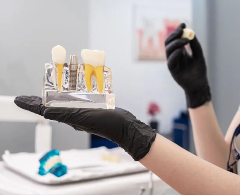 Dental Implants in The Woodlands, TX - Dentistry and Orthodontics