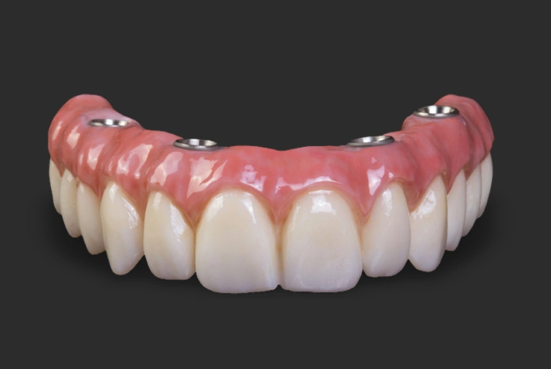 Benefits - Dentures in The Woodlands, TX