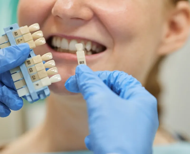 Do You Need - Dental Implants in The Woodlands, TX
