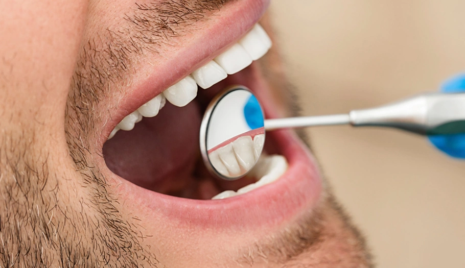 Oral Pathology - The Woodlands, TX - Dentistry and Orthodontics