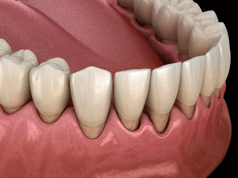 Signs of Oral Tissue Changes - The Woodlands Dentistry and Orthodontics