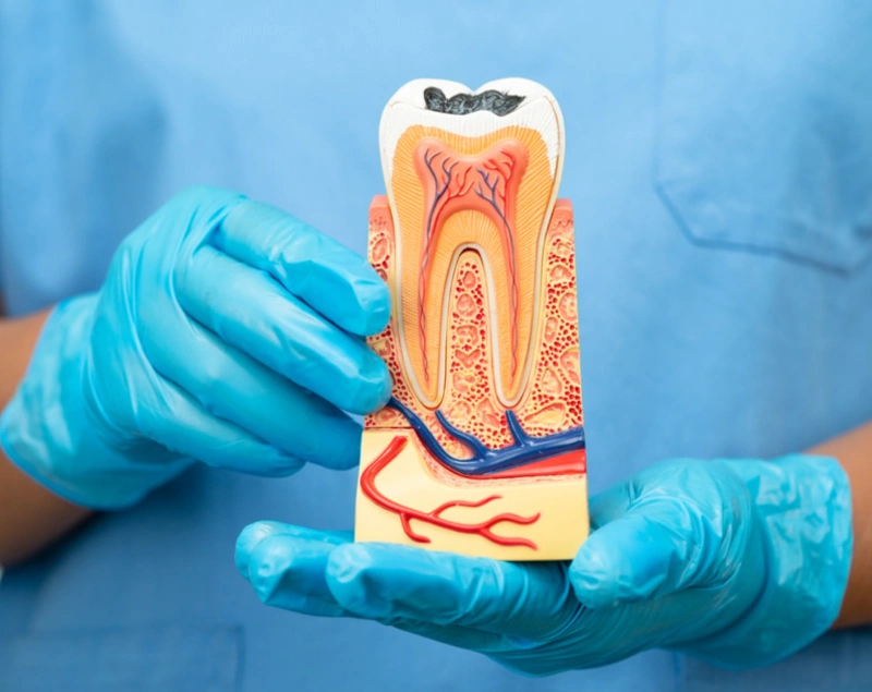 Root Canal Retreatment in The Woodlands, TX - Dentistry and Orthodontics