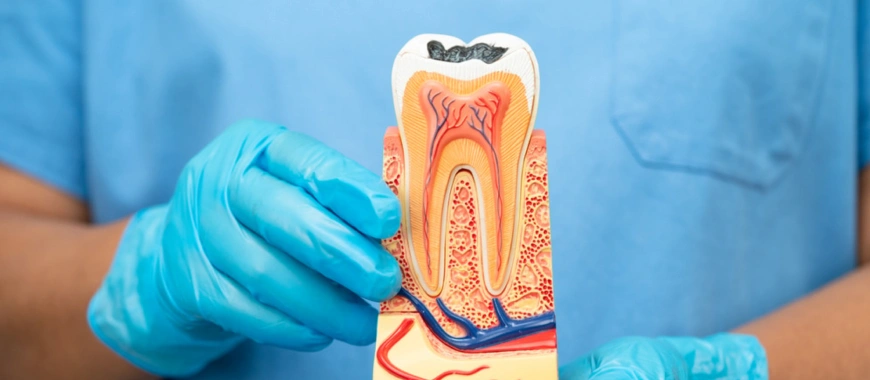 Root Canal Therapy - The Woodlands, TX - Dentistry and Orthodontics