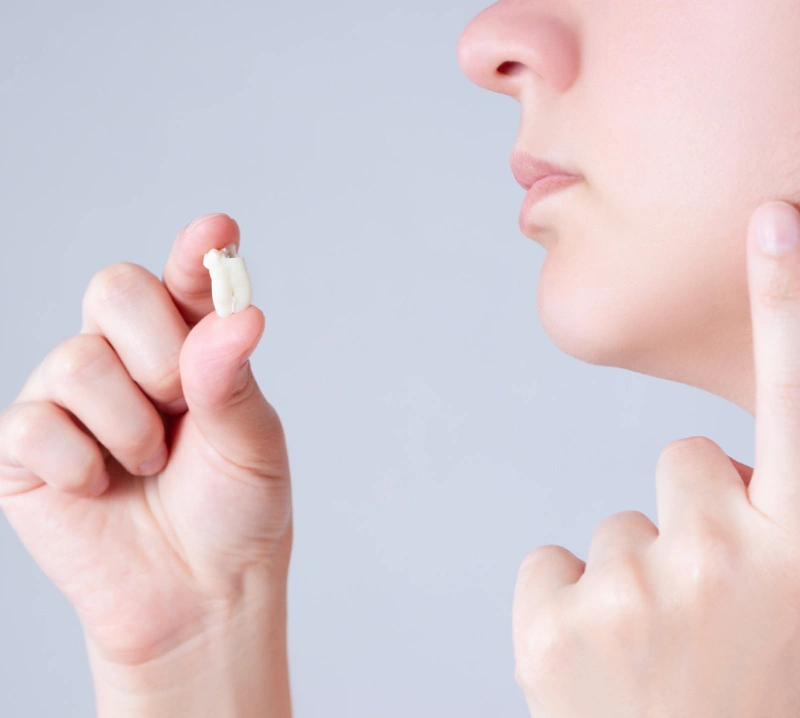 Procedure - Simple Tooth Extractions in The Woodlands, TX