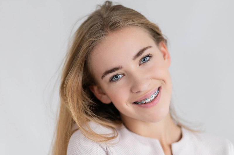 Candidacy - Six Month Smiles in The Woodlands, TX