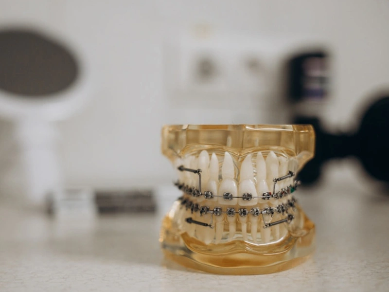 Traditional Braces in The Woodlands, TX - Dentistry and Orthodontics
