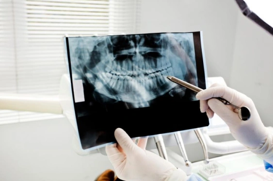 Digital X-Ray System - The Woodlands, TX - Dentistry and Orthodontics